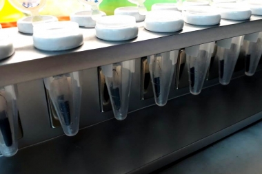 En la Provincia desarrollarán un kit rápido de testeo de Covid a través de nanopartículas