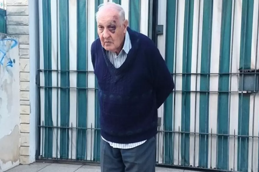 Brutal: delincuentes ataron y golpearon a un jubilado para robarle en su casa