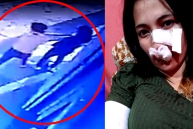 Video: le estaba robando y la acuchilló en el rostro porque la había reconocido