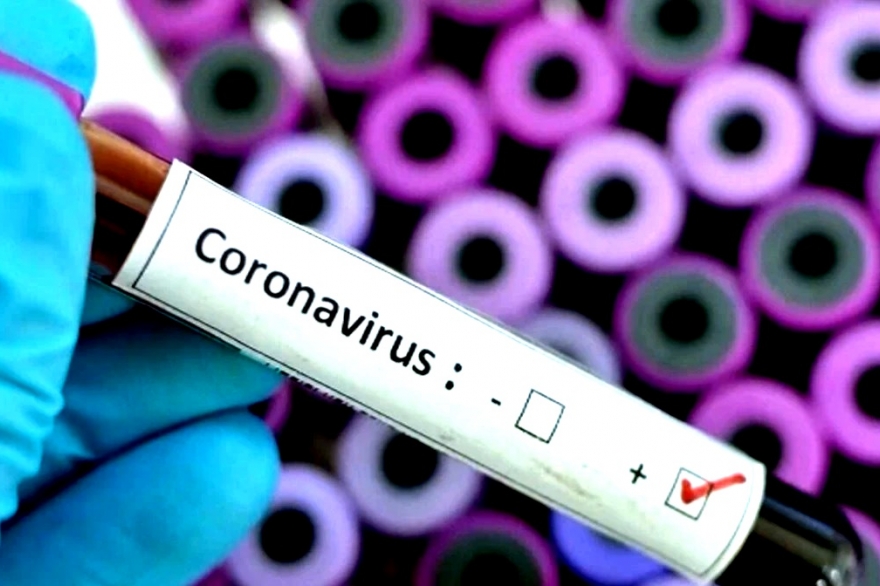 Cómo prevenir y detectar posibles síntomas del Coronavirus: mirá los detalles y consejos