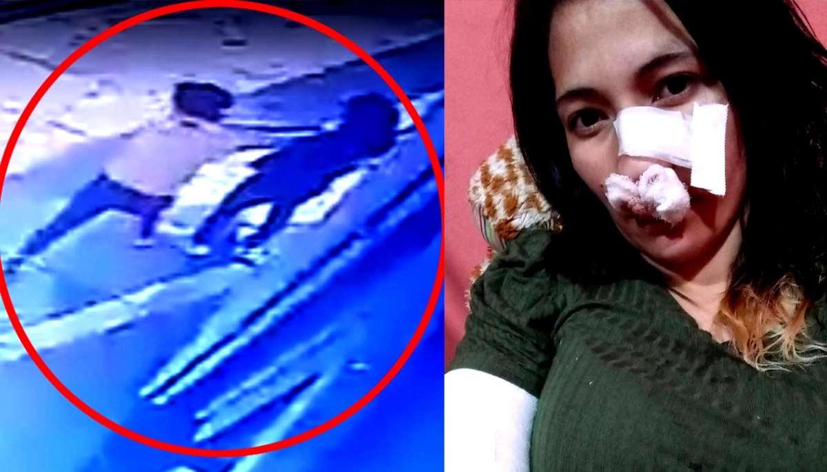 Video: le estaba robando y la acuchilló en el rostro porque la había reconocido