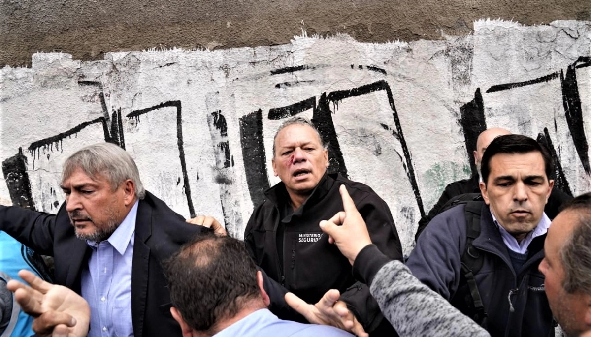 Berni habló después del ataque: “Yo siempre ando solo y nunca huyo del lugar”