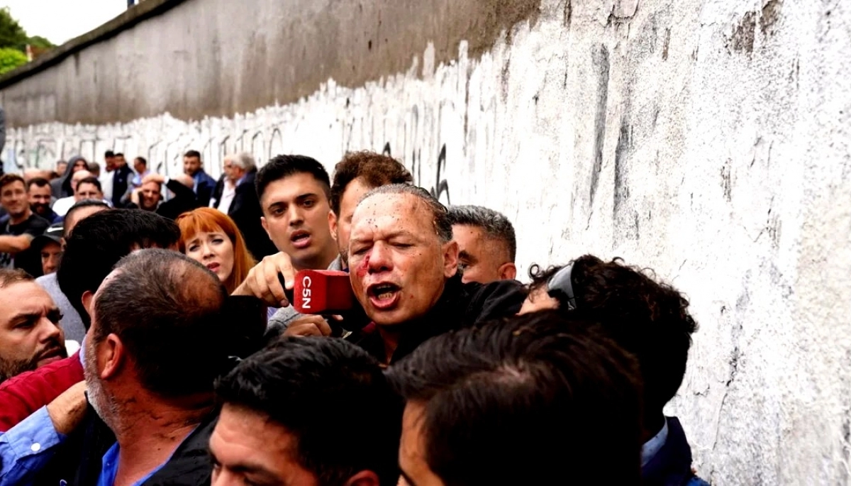 “Fracaso Absoluto” y “Viva Perón” las reacciones de la política sobre el ataque a Berni