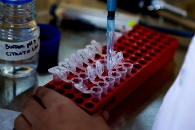 Bioquímicos empezarán a cobrar una suma adicional a un millón de pacientes bonaerenses