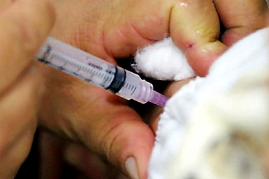 Detectan el primer caso de sarampión en territorio bonaerense: en el país suman 48