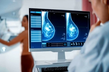 Ioma se suma la Noche de las Mamografías: cuándo y dónde se realizarán