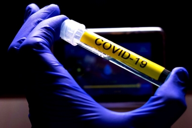 Argentina fue elegida para probar una de las vacunas más avanzadas contra el Coronavirus